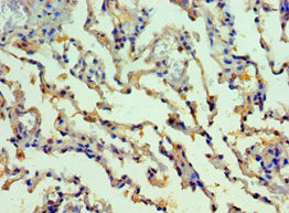 Immunohistochemistry of paraffin-embedded human lung tissue using SMYD1 Antibody at dilution of 1:100Rabbit anti-Human SMYD1 Polyclonal Antibody