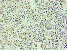Immunohistochemistry of paraffin-embedded human spleen tissue using SMYD1 Antibody at dilution of 1:100Rabbit anti-Human SMYD1 Polyclonal Antibody