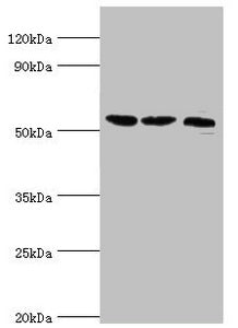 Western blot | All lanes: Histone-lysine N-methyltransferase SMYD1 antibody at 2μg/ml | Lane 1: Mouse heart tissue | Lane 2: 293T whole cell lysate | Lane 3: Mouse skeletal muscle tissue | Secondary | Goat polyclonal to rabbit IgG at 1/10000 dilution | Predicted band size: 57 kDa | Observed band size: 57 kDaRabbit anti-Human SMYD1 Polyclonal Antibody