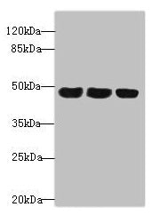 Western blot | All lanes: TXNDC5 antibody at 4.9μg/ml | Lane 1: HepG2 whole cell lysate | Lane 2: Colo320 whole cell lysate | Lane 3: Mouse stomach tissue | Secondary | Goat polyclonal to rabbit IgG at 1/10000 dilution | Predicted band size: 48, 37 kDa | Observed band size: 48 kDaRabbit anti-Human TXNDC5 Polyclonal Antibody