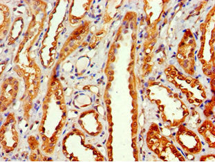 Immunohistochemistry of paraffin-embedded human kidney tissue using MTMR14 Antibody at dilution of 1:100Rabbit anti-Human MTMR14 Polyclonal Antibody