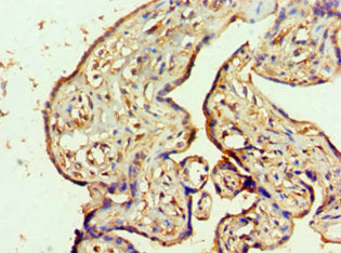 Immunohistochemistry of paraffin-embedded human placenta tissue using MTMR14 Antibody at dilution of 1:100Rabbit anti-Human MTMR14 Polyclonal Antibody