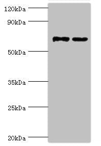 Western blot | All lanes: Myotubularin-related protein 14 antibody at 10μg/ml | Lane 1: Hela whole cell lysate | Lane 2: Mouse skeletal muscle tissue | Secondary | Goat polyclonal to rabbit IgG at 1/10000 dilution | Predicted band size: 73, 67, 61 kDa | Observed band size: 73 kDaRabbit anti-Human MTMR14 Polyclonal Antibody