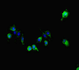 Immunofluorescent analysis of Hela cells using GALNT11 Antibody at dilution of 1:100 and Alexa Fluor 488-congugated AffiniPure Goat Anti-Rabbit IgG(H+L)Rabbit anti-Human GALNT11 Polyclonal Antibody