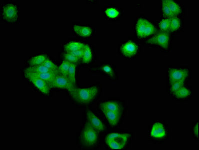 Immunofluorescence staining of HepG2 cells with CCNY Antibody at 1:200, counter-stained with DAPI. The cells were fixed in 4% formaldehyde, permeabilized using 0.2% Triton X-100 and blocked in 10% normal Goat Serum. The cells were then incubated with the antibody overnight at 4°C. The secondary antibody was Alexa Fluor 488-congugated AffiniPure Goat Anti-Rabbit IgG(H+L).Rabbit anti-Human CCNY Polyclonal Antibody