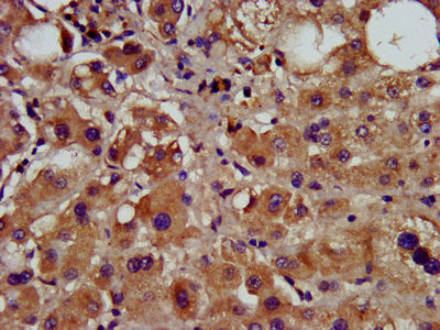 IHC image of CCNY Antibody diluted at 1:600 and staining in paraffin-embedded human liver tissue performed on a Leica BondTM system. After dewaxing and hydration, antigen retrieval was mediated by high pressure in a citrate buffer (pH 6.0). Section was blocked with 10% normal goat serum 30min at RT. Then primary antibody (1% BSA) was incubated at 4°C overnight. The primary is detected by a biotinylated secondary antibody and visualized using an HRP conjugated SP system.Rabbit anti-Human CCNY Polyclonal Antibody