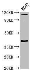 Western Blot  | Positive WB detected in: K562 whole cell lysate  | All lanes: CCNY antibody at 6µg/ml  | Secondary  | Goat polyclonal to rabbit IgG at 1/50000 dilution  | Predicted band size: 40, 37, 34 kDa  | Observed band size: 40 kDa