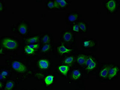 Immunofluorescent analysis of MCF-7 cells using FAM156A Antibody at dilution of 1:100 and Alexa Fluor 488-congugated AffiniPure Goat Anti-Rabbit IgG(H+L)Rabbit anti-Human FAM156A Polyclonal Antibody