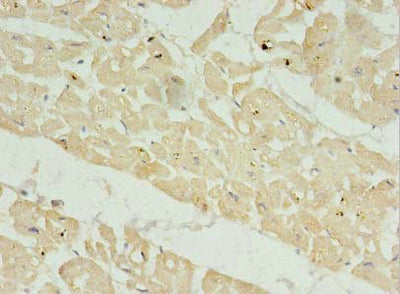 Immunohistochemistry of paraffin-embedded human heart tissue using FAM156A Antibody at dilution of 1:100Rabbit anti-Human FAM156A Polyclonal Antibody