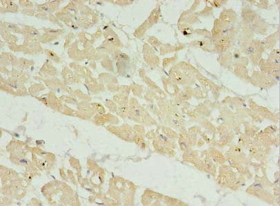 Immunohistochemistry of paraffin-embedded human heart tissue using FAM156A Antibody at dilution of 1:100Rabbit anti-Human FAM156A Polyclonal Antibody