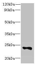 Western blot  | All lanes: FAM156A antibody at 5µg/ml + Mouse heart tissue  | Secondary  | Goat polyclonal to rabbit IgG at 1/10000 dilution  | Predicted band size: 25 kDa  | Observed band size: 25 kDaRabbit anti-Human FAM156A Polyclonal Antibody