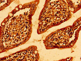 Immunohistochemistry of paraffin-embedded human small intestine tissue using MCU Antibody at dilution of 1:100