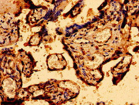 Immunohistochemistry of paraffin-embedded human placenta tissue using MCU Antibody at dilution of 1:100