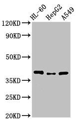 Western Blot  | Positive WB detected in: HL60 whole cell lysate, HepG2 whole cell lysate, A549 whole cell lysate  | All lanes: MCU antibody at 3.4µg/ml  | Secondary  | Goat polyclonal to rabbit IgG at 1/50000 dilution  | Predicted band size: 40, 37, 36 kDa  | Observed band size: 40 kDa