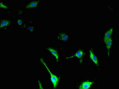 Immunofluorescent analysis of U251 cells using the antibody at dilution of 1:100 and Alexa Fluor 488-congugated AffiniPure Goat Anti-Rabbit IgG(H+L)Rabbit anti-Human TSPAN14 Polyclonal Antibody
