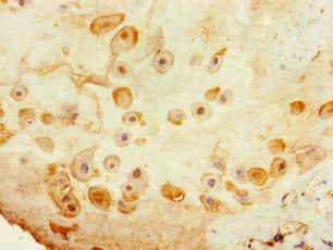 Immunohistochemistry of paraffin-embedded human placenta tissue using TSPAN14 Antibody at dilution of 1:100Rabbit anti-Human TSPAN14 Polyclonal Antibody