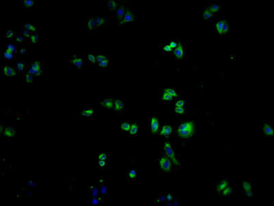 Immunofluorescence staining of Hela cells with OR1K1 Antibody at 1:100, counter-stained with DAPI. The cells were fixed in 4% formaldehyde and blocked in 10% normal Goat Serum. The cells were then incubated with the antibody overnight at 4°C. The secondary antibody was Alexa Fluor 488-congugated AffiniPure Goat Anti-Rabbit IgG(H+L).Rabbit anti-Human OR1K1 Polyclonal Antibody