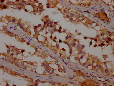 IHC image of OR1K1 Antibody diluted at 1:200 and staining in paraffin-embedded human testis tissue performed on a Leica BondTM system. After dewaxing and hydration, antigen retrieval was mediated by high pressure in a citrate buffer (pH 6.0). Section was blocked with 10% normal goat serum 30min at RT. Then primary antibody (1% BSA) was incubated at 4°C overnight. The primary is detected by a Goat anti-rabbit polymer IgG labeled by HRP and visualized using 0.05% DAB.Rabbit anti-Human OR1K1 Polyclonal Antibody