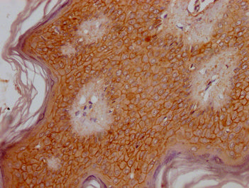 IHC image of OR6B3 Antibody diluted at 1:300 and staining in paraffin-embedded human skin tissue performed on a Leica BondTM system. After dewaxing and hydration, antigen retrieval was mediated by high pressure in a citrate buffer (pH 6.0). Section was blocked with 10% normal goat serum 30min at RT. Then primary antibody (1% BSA) was incubated at 4°C overnight. The primary is detected by a Goat anti-rabbit polymer IgG labeled by HRP and visualized using 0.05% DAB.Rabbit anti-Human OR6B3 Polyclonal Antibody