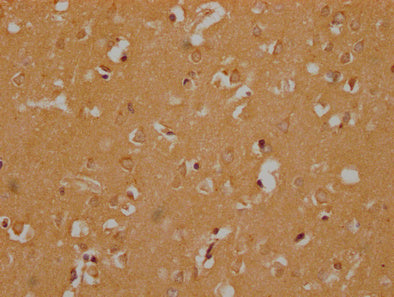 IHC image of OR6B3 Antibody diluted at 1:300 and staining in paraffin-embedded human brain tissue performed on a Leica BondTM system. After dewaxing and hydration, antigen retrieval was mediated by high pressure in a citrate buffer (pH 6.0). Section was blocked with 10% normal goat serum 30min at RT. Then primary antibody (1% BSA) was incubated at 4°C overnight. The primary is detected by a Goat anti-rabbit polymer IgG labeled by HRP and visualized using 0.05% DAB.Rabbit anti-Human OR6B3 Polyclonal Antibody