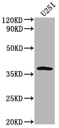 Western Blot | Positive WB detected in: U251 whole cell lysate | All lanes: OR6B3 antibody at 1:2000 | Secondary | Goat polyclonal to rabbit IgG at 1/50000 dilution | Predicted band size: 38 kDa | Observed band size: 38 kDaRabbit anti-Human OR6B3 Polyclonal Antibody