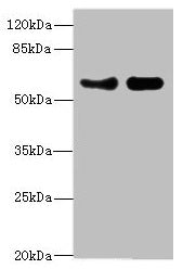 Western blot  | All lanes: VANGL1 antibody at 3.38µg/ml  | Lane 1: PC-3 whole cell lysate  | Lane 2: Hela whole cell lysate  | Secondary  | Goat polyclonal to rabbit IgG at 1/10000 dilution  | Predicted band size: 60 kDa  | Observed band size: 60 kDaRabbit anti-Human VANGL1 Polyclonal Antibody