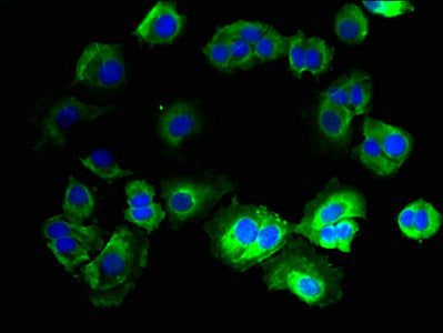Immunofluorescent analysis of MCF-7 cells using CNIH3 Antibody at dilution of 1:100 and Alexa Fluor 488-congugated AffiniPure Goat Anti-Rabbit IgG(H+L)Rabbit anti-Human CNIH3 Polyclonal Antibody