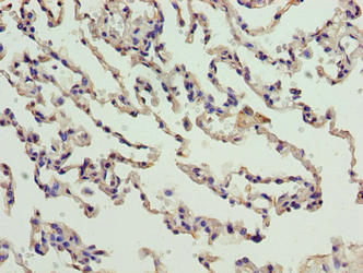 Immunohistochemistry of paraffin-embedded human lung tissue using the antibody at dilution of 1:100Rabbit anti-Human CNIH3 Polyclonal Antibody