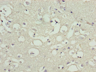 Immunohistochemistry of paraffin-embedded human brain tissue using CNIH3 Antibody at dilution of 1:100Rabbit anti-Human CNIH3 Polyclonal Antibody