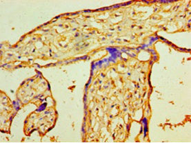 Immunohistochemistry of paraffin-embedded human placenta tissue using PIGX Antibody at dilution of 1:100Rabbit anti-Human PIGX Polyclonal Antibody