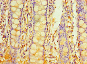 Immunohistochemistry of paraffin-embedded human colon tissue using PIGX Antibody at dilution of 1:100Rabbit anti-Human PIGX Polyclonal Antibody