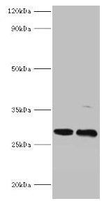Western blot  | All lanes: PIGX antibody at 2µg/ml  | Lane 1: Mouse kidney tissue  | Lane 2: 293T whole cell lysate  | Secondary  | Goat polyclonal to rabbit IgG at 1/10000 dilution  | Predicted band size: 29, 31 kDa  | Observed band size: 29 kDaRabbit anti-Human PIGX Polyclonal Antibody