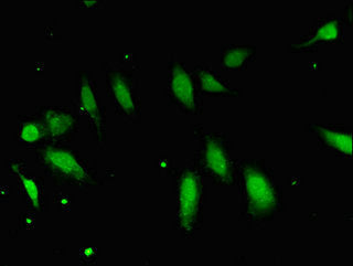 Immunofluorescent analysis of Hela cells using FBXO25 Antibody at dilution of 1:100 and Alexa Fluor 488-congugated AffiniPure Goat Anti-Rabbit IgG(H+L)Rabbit anti-Human FBXO25 Polyclonal Antibody