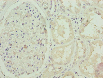 Immunohistochemistry of paraffin-embedded human kidney tissue using the antibody at dilution of 1:100Rabbit anti-Human FBXO25 Polyclonal Antibody