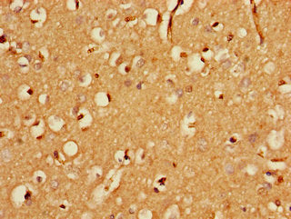 Immunohistochemistry of paraffin-embedded human brain tissue using FBXO25 Antibody at dilution of 1:100Rabbit anti-Human FBXO25 Polyclonal Antibody