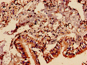 Immunocytochemistry analysis of human lung tissue using PREX1 Antibody at dilution of 1:100