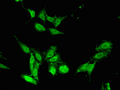 Immunofluorescent analysis of Hela cells using CHD5 Antibody at dilution of 1:100 and Alexa Fluor 488-congugated AffiniPure Goat Anti-Rabbit IgG(H+L)