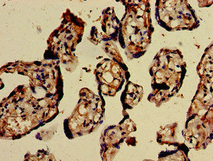 Immunohistochemistry of paraffin-embedded human placenta tissue using CHD5 Antibody at dilution of 1:100
