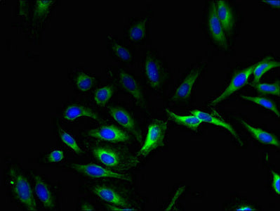 Immunofluorescent analysis of Hela cells using the antibody at dilution of 1:100 and Alexa Fluor 488-congugated AffiniPure Goat Anti-Rabbit IgG(H+L)Rabbit anti-Human GPX8 Polyclonal Antibody