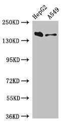Western Blot | Positive WB detected in: HepG2 whole cell lysate, A549 whole cell lysate | All lanes: DOT1L antibody at 3μg/ml | Secondary | Goat polyclonal to rabbit IgG at 1/50000 dilution | Predicted band size: 185, 165 kDa | Observed band size: 185 kDaRabbit anti-Human DOT1L Polyclonal Antibody