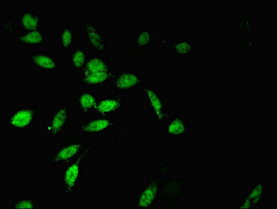 Immunofluorescent analysis of Hela cells using TWIST2 Antibody at dilution of 1:100 and Alexa Fluor 488-congugated AffiniPure Goat Anti-Rabbit IgG(H+L)Rabbit anti-Human TWIST2 Polyclonal Antibody