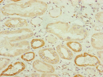 Immunohistochemistry of paraffin-embedded human kidney tissue using the antibody at dilution of 1:100Rabbit anti-Human TWIST2 Polyclonal Antibody