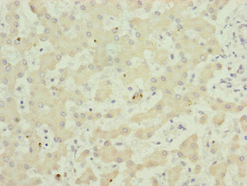 Immunohistochemistry of paraffin-embedded human liver tissue using TWIST2 Antibody at dilution of 1:100Rabbit anti-Human TWIST2 Polyclonal Antibody