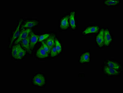 Immunofluorescence staining of HepG2 cells with NEU4 Antibody at 1:133, counter-stained with DAPI. The cells were fixed in 4% formaldehyde, permeabilized using 0.2% Triton X-100 and blocked in 10% normal Goat Serum. The cells were then incubated with the antibody overnight at 4°C. The secondary antibody was Alexa Fluor 488-congugated AffiniPure Goat Anti-Rabbit IgG(H+L).Rabbit anti-Human NEU4 Polyclonal Antibody