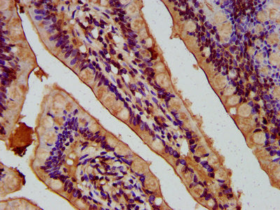 IHC image of the antibody diluted at 1:400 and staining in paraffin-embedded human small intestine tissue performed on a Leica BondTM system. After dewaxing and hydration, antigen retrieval was mediated by high pressure in a citrate buffer (pH 6.0). Section was blocked with 10% normal goat serum 30min at RT. Then primary antibody (1% BSA) was incubated at 4°C overnight. The primary is detected by a biotinylated secondary antibody and visualized using an HRP conjugated SP system.Rabbit anti-Human NEU4 Polyclonal Antibody