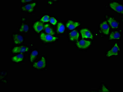 Immunofluorescence staining of A549 cells with LIPH Antibody at 1:66, counter-stained with DAPI. The cells were fixed in 4% formaldehyde, permeabilized using 0.2% Triton X-100 and blocked in 10% normal Goat Serum. The cells were then incubated with the antibody overnight at 4°C. The secondary antibody was Alexa Fluor 488-congugated AffiniPure Goat Anti-Rabbit IgG(H+L).