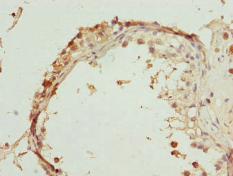 Immunohistochemistry of paraffin-embedded human testis tissue using RUFY2 Antibody at dilution of 1:100Rabbit anti-Human RUFY2 Polyclonal Antibody