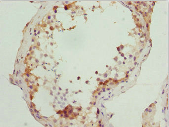 Immunohistochemistry of paraffin-embedded human testis tissue using RUFY2 Antibody at dilution of 1:100Rabbit anti-Human RUFY2 Polyclonal Antibody