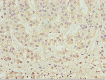 Immunohistochemistry of paraffin-embedded human adrenal gland tissue using RUFY2 Antibody at dilution of 1:100Rabbit anti-Human RUFY2 Polyclonal Antibody