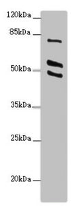Western blot | All lanes: RUFY2 antibody at 2.4μg/ml + PC-3 whole cell lysate | Secondary | Goat polyclonal to rabbit IgG at 1/10000 dilution | Predicted band size: 76, 71, 75, 47, 44 kDa | Observed band size: 76, 55, 49 kDaRabbit anti-Human RUFY2 Polyclonal Antibody